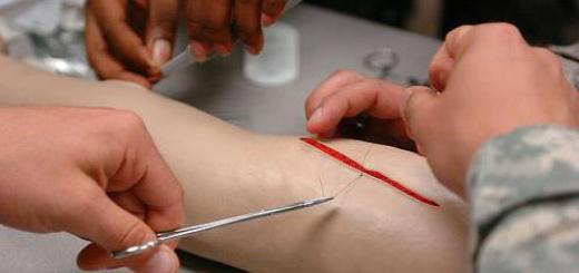 Self-absorbing sutures: types, healing time Threads for suturing wounds